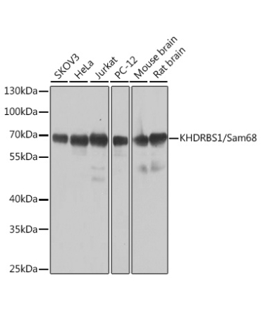 KHDRBS1/Sam68 Rabbit Polyclonal Antibody