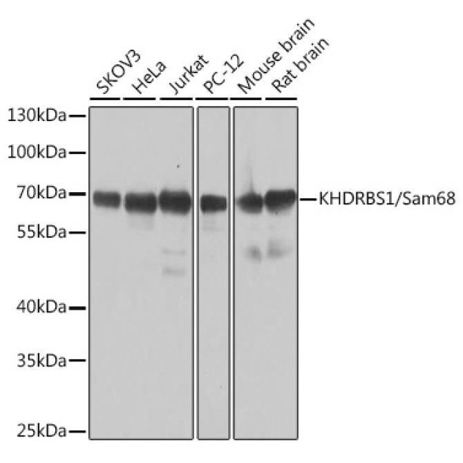 KHDRBS1/Sam68 Rabbit Polyclonal Antibody