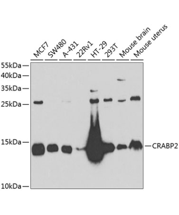 CRABP2 Rabbit Polyclonal Antibody