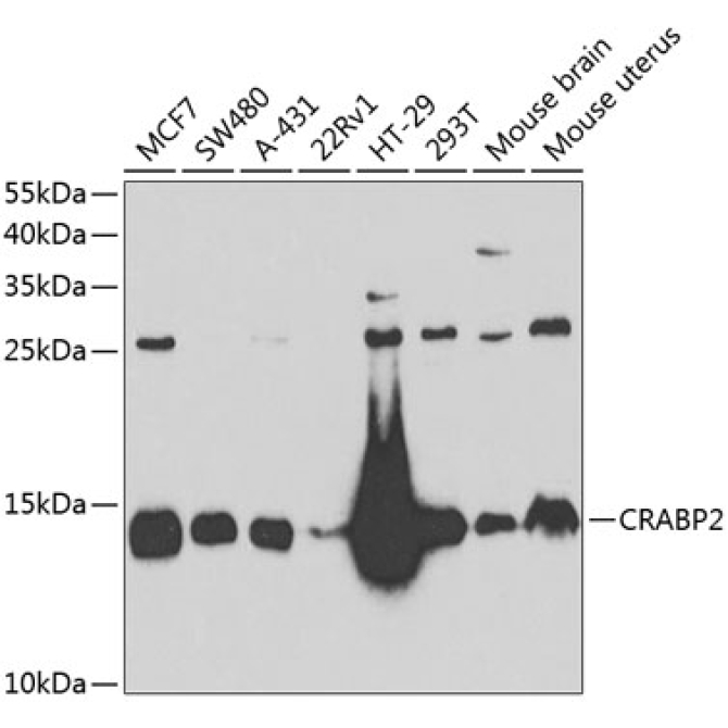 CRABP2 Rabbit Polyclonal Antibody
