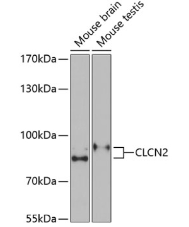 CLCN2 Rabbit Polyclonal Antibody