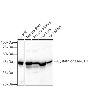 Cystathionase/CTH Rabbit Polyclonal Antibody