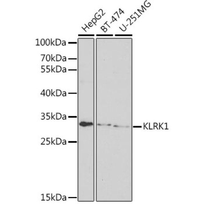 KLRK1 Rabbit Polyclonal Antibody