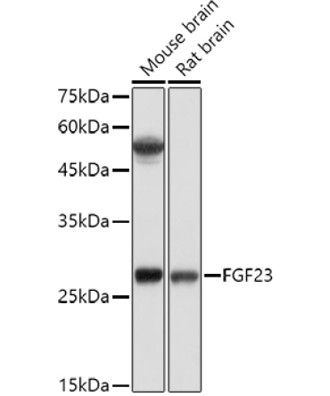 FGF23 Rabbit Polyclonal Antibody