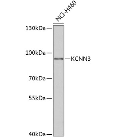 KCNN3 Rabbit Polyclonal Antibody