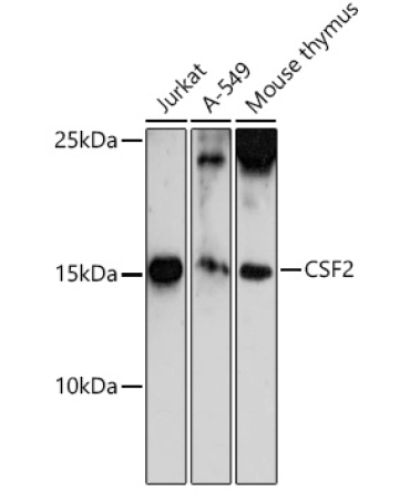 CSF2 Rabbit Polyclonal Antibody