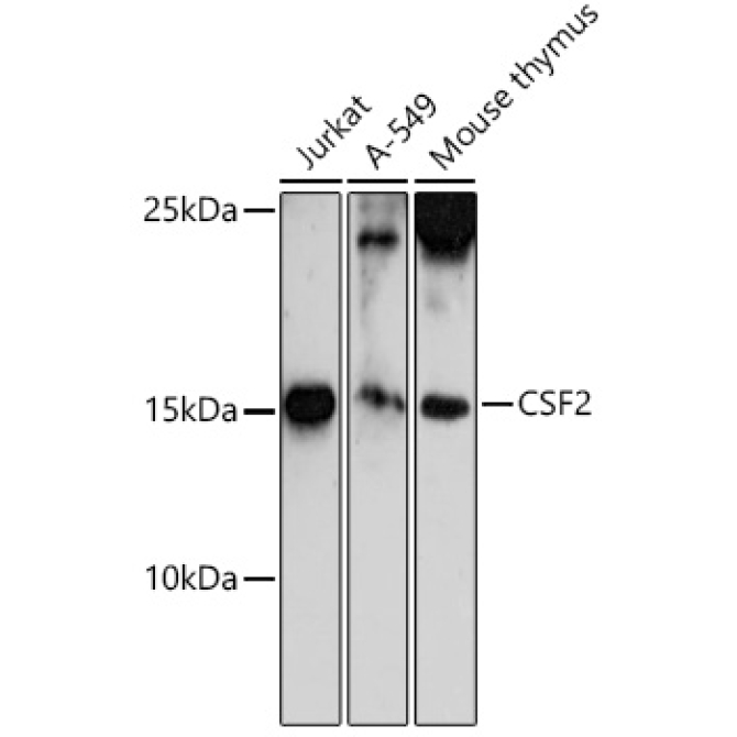 CSF2 Rabbit Polyclonal Antibody