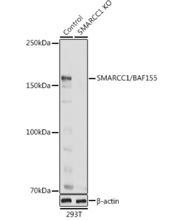 SMARCC1/BAF155 Rabbit Polyclonal Antibody [KO Validated]