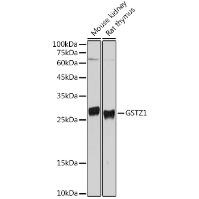 GSTZ1 Rabbit Polyclonal Antibody