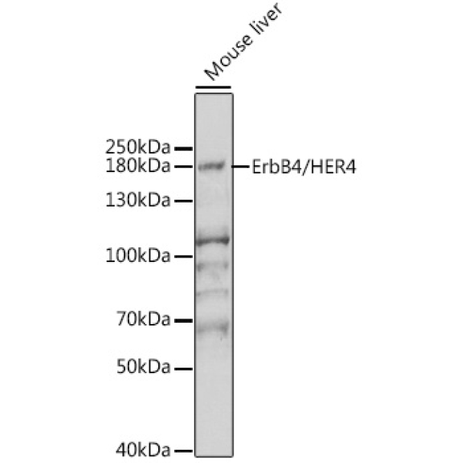 ErbB4/HER4 Rabbit Polyclonal Antibody