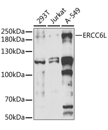 ERCC6L Rabbit Polyclonal Antibody