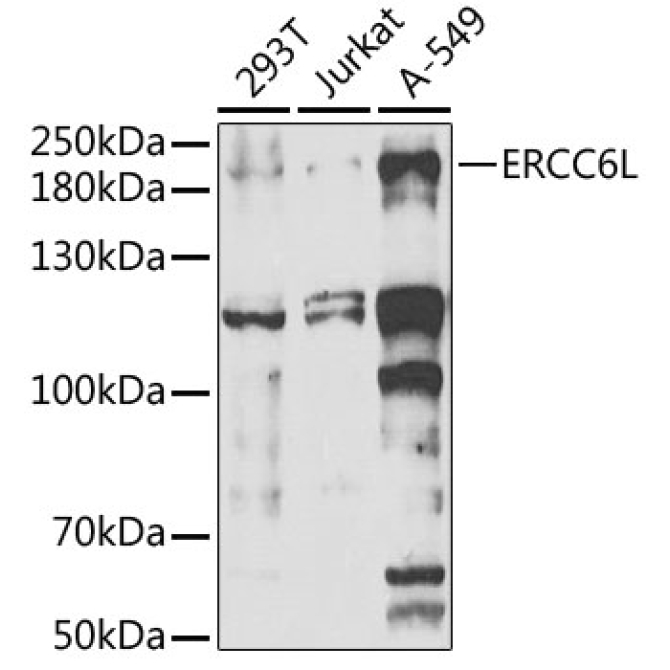 ERCC6L Rabbit Polyclonal Antibody