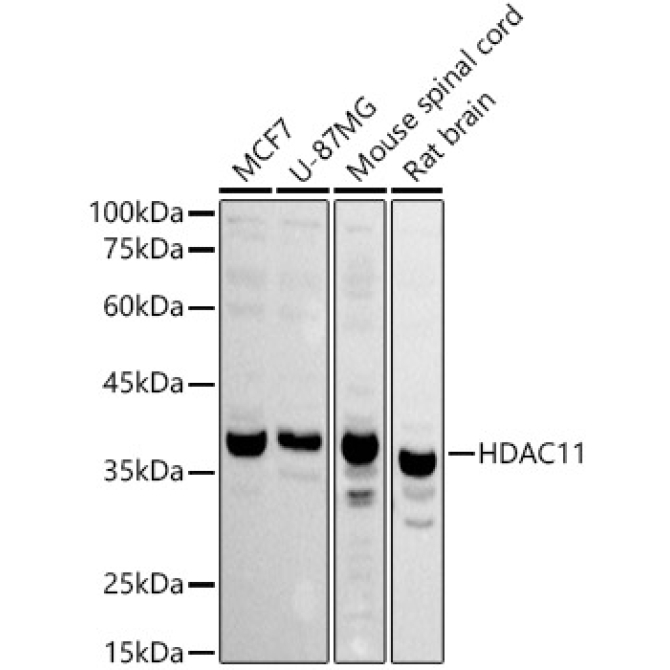 HDAC11 Rabbit Polyclonal Antibody