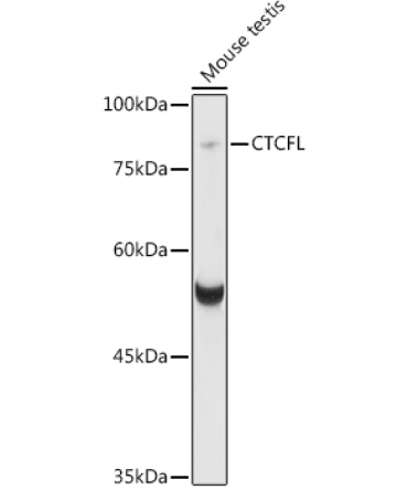 CTCFL Rabbit Polyclonal Antibody