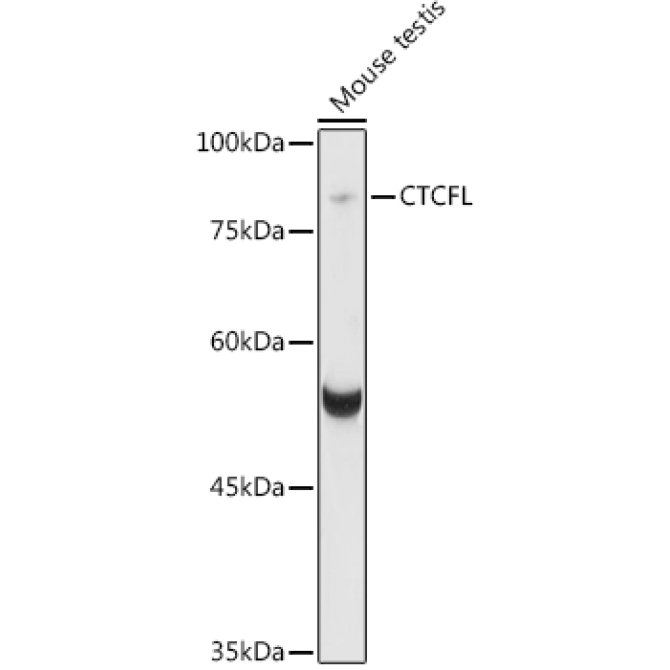 CTCFL Rabbit Polyclonal Antibody
