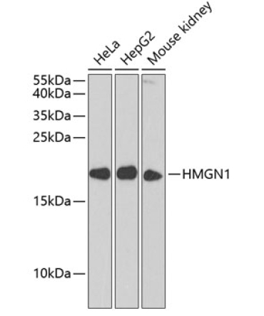 HMGN1 Rabbit Polyclonal Antibody