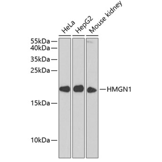 HMGN1 Rabbit Polyclonal Antibody