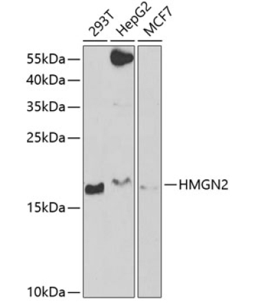 HMGN2 Rabbit Polyclonal Antibody