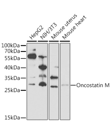 Oncostatin M Rabbit Polyclonal Antibody