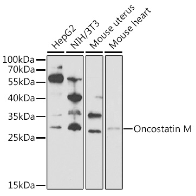 Oncostatin M Rabbit Polyclonal Antibody