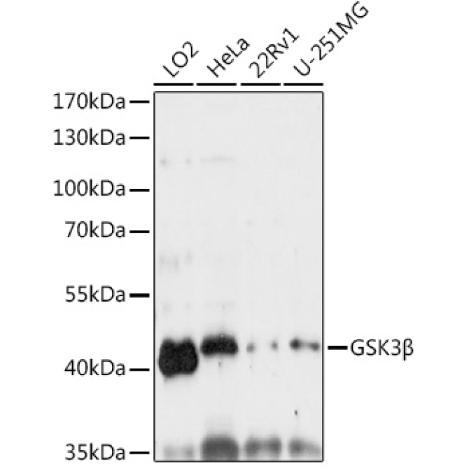 GSK3Beta Rabbit Polyclonal Antibody