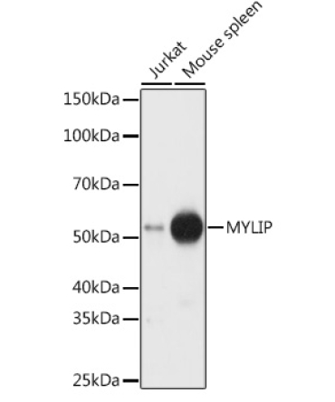 MYLIP Rabbit Polyclonal Antibody