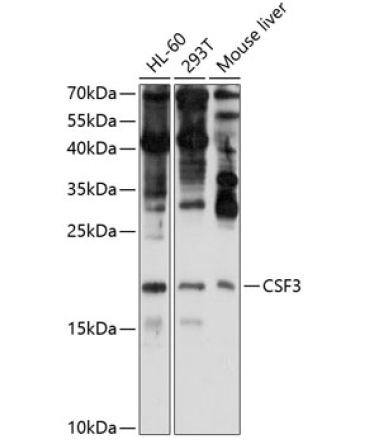 CSF3 Rabbit Polyclonal Antibody