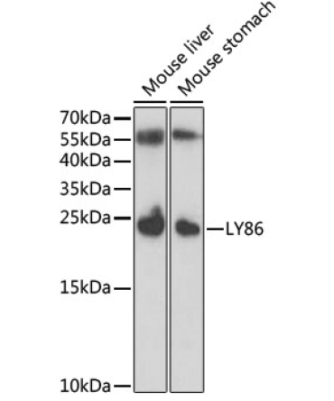 LY86 Rabbit Polyclonal Antibody