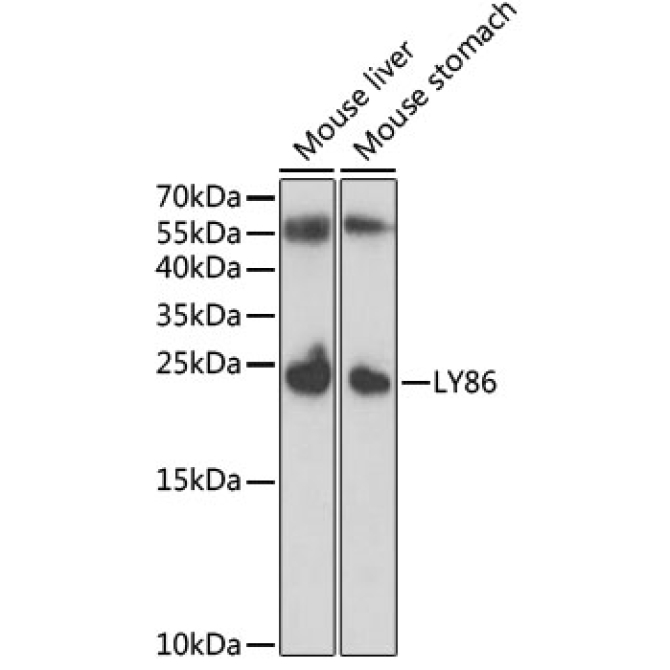 LY86 Rabbit Polyclonal Antibody