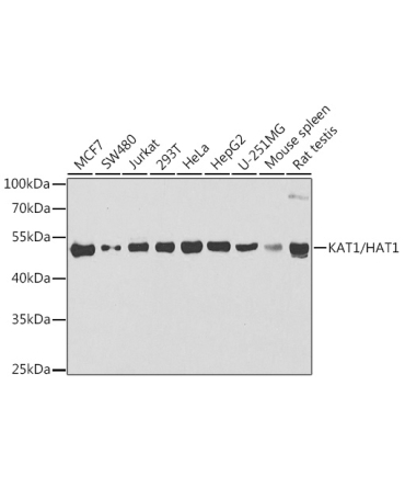 KAT1/HAT1 Rabbit Polyclonal Antibody