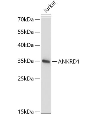 ANKRD1 Rabbit Polyclonal Antibody