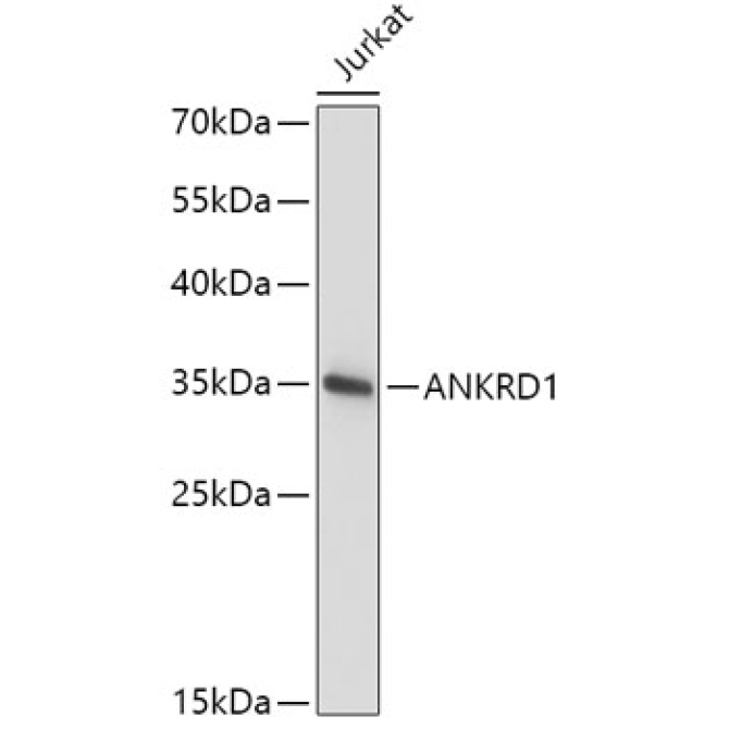 ANKRD1 Rabbit Polyclonal Antibody