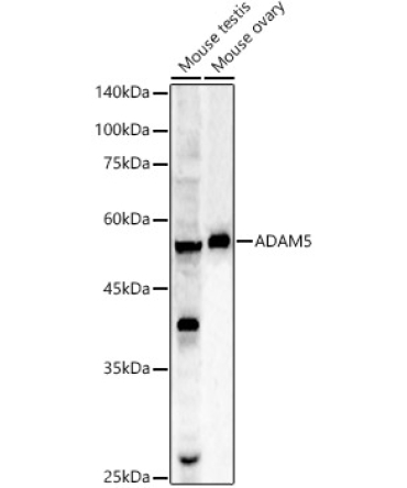 ADAM5 Rabbit Polyclonal Antibody
