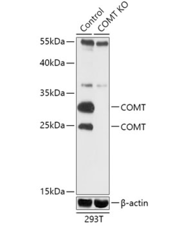 COMT Rabbit Polyclonal Antibody