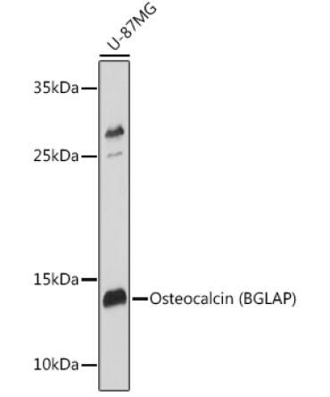 Osteocalcin (BGLAP) Rabbit Polyclonal Antibody