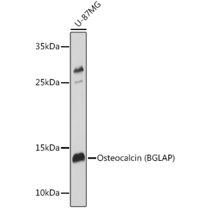 Osteocalcin (BGLAP) Rabbit Polyclonal Antibody