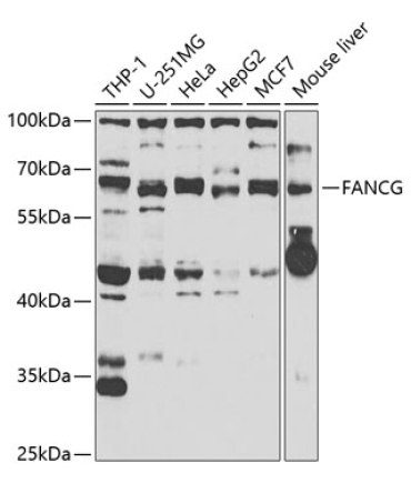 FANCG Rabbit Polyclonal Antibody