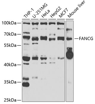 FANCG Rabbit Polyclonal Antibody