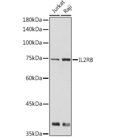 IL2RB Rabbit Polyclonal Antibody