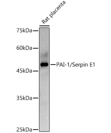 PAI-1/Serpin E1 Rabbit Polyclonal Antibody