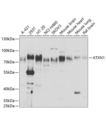 ATXN1 Rabbit Polyclonal Antibody