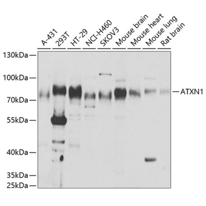 ATXN1 Rabbit Polyclonal Antibody
