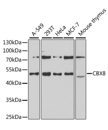 CBX8 Rabbit Polyclonal Antibody