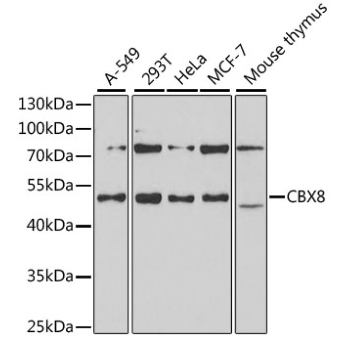 CBX8 Rabbit Polyclonal Antibody
