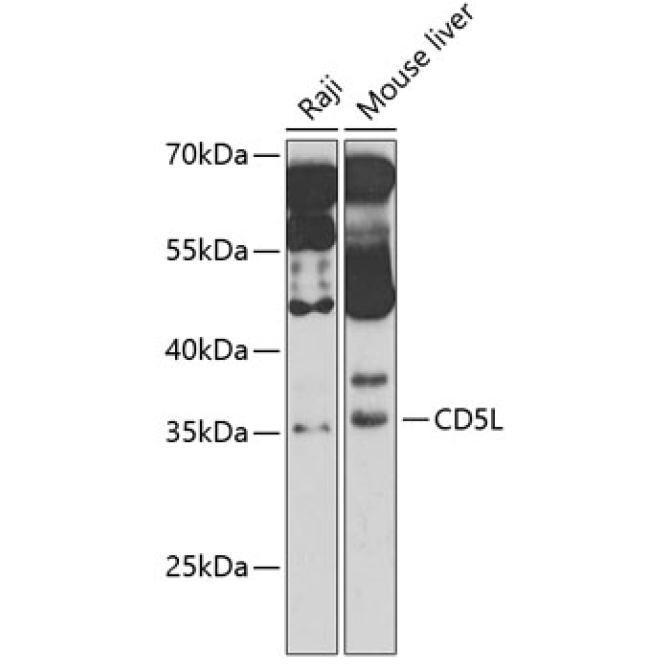 CD5L Rabbit Polyclonal Antibody