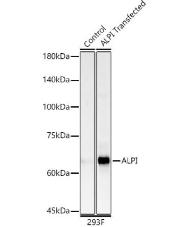 ALPI Rabbit Polyclonal Antibody