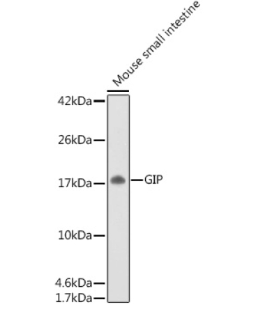 GIP Rabbit Polyclonal Antibody