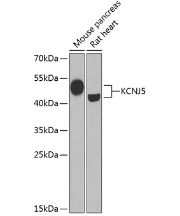 KCNJ5 Rabbit Polyclonal Antibody