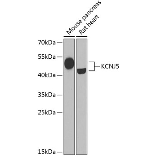 KCNJ5 Rabbit Polyclonal Antibody