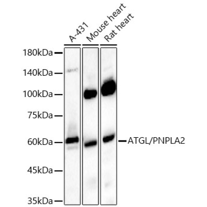 ATGL/PNPLA2 Rabbit Polyclonal Antibody